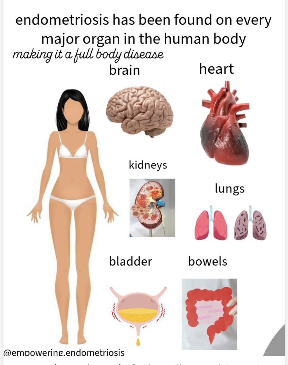 CWengaard's tweet image. March is Endometriosis Awareness Month,&amp;amp; I know too well what it’s like living with Endo.I have been through hell.Being mistreated &amp;amp; gaslit in the health care system.

My heart goes out to EVERYONE in the same situation♥️🙏

#Endometriosis #chronicillness #pain #fatigue