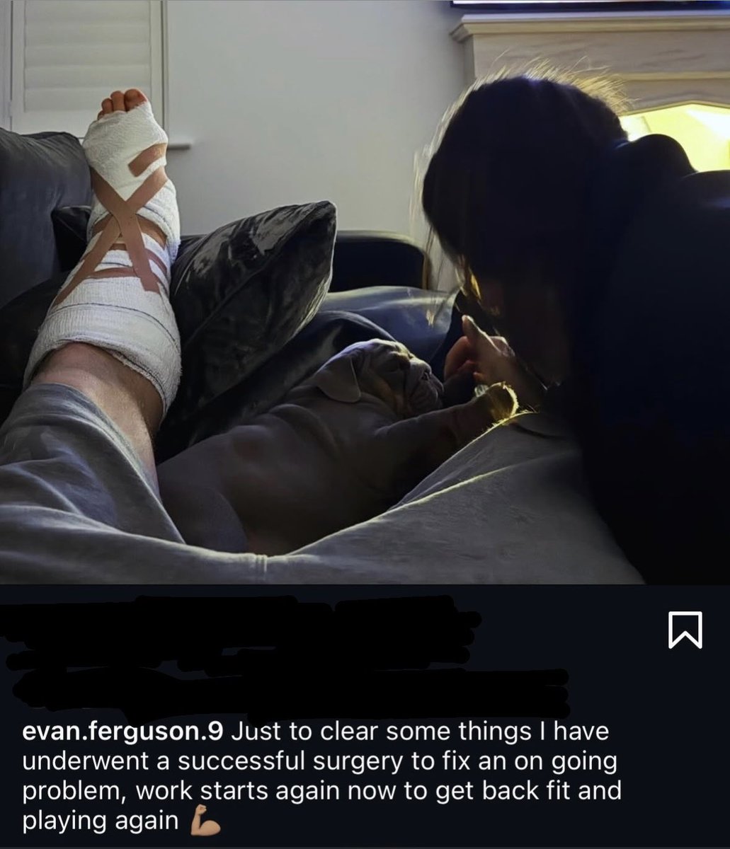 Ste_Gentili_'s tweet image. Operazione alla caviglia riuscita per Evan #Ferguson. Nei prossimi giorni l’attaccante di proprietà del #Brighton inizierà il percorso di recupero. Prima di uscire di scena per il dolore alla caviglia, l’irlandese aveva raccolto 5 gol e 2 assist in 1078 minuti con l’#ASRoma.