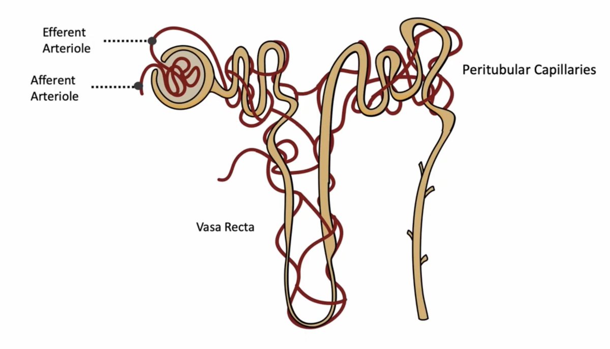 ▶️ youtu.be/ufco0XpjP7s

#nephron #microanatomy from the #glomerulus → #PCT → #Loop of Henle →# DCT → collecting duct

🧠 Macula densa
🩸 #RAAS regulation
💧 #TGF

🔬 Immersive learning abckidney.com

#RenalPhysiology #MedEd #FOAMed #USMLE #NephX