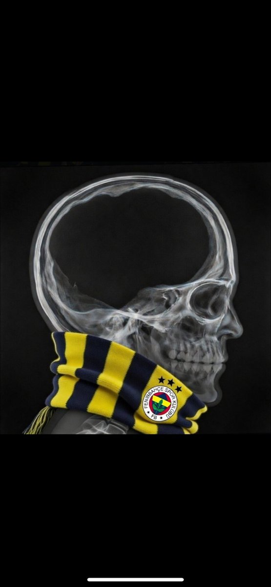 Allahım sen bunları bi 5-10 yıl daha bu kafayla tut başka bir şey istemiyorum!. 
Bir lop eklenirse belki, 
ama yine de sanmıyorum.
Böyle devam !
😂

💛❤️

 #GSvLIV #Hedef26 #Galatasaray #Osimhen #OkanBuruk