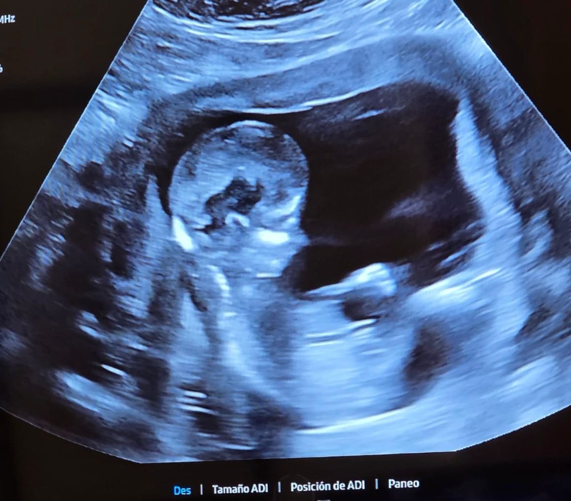 M. Nolan Gray 🥑 tweet media