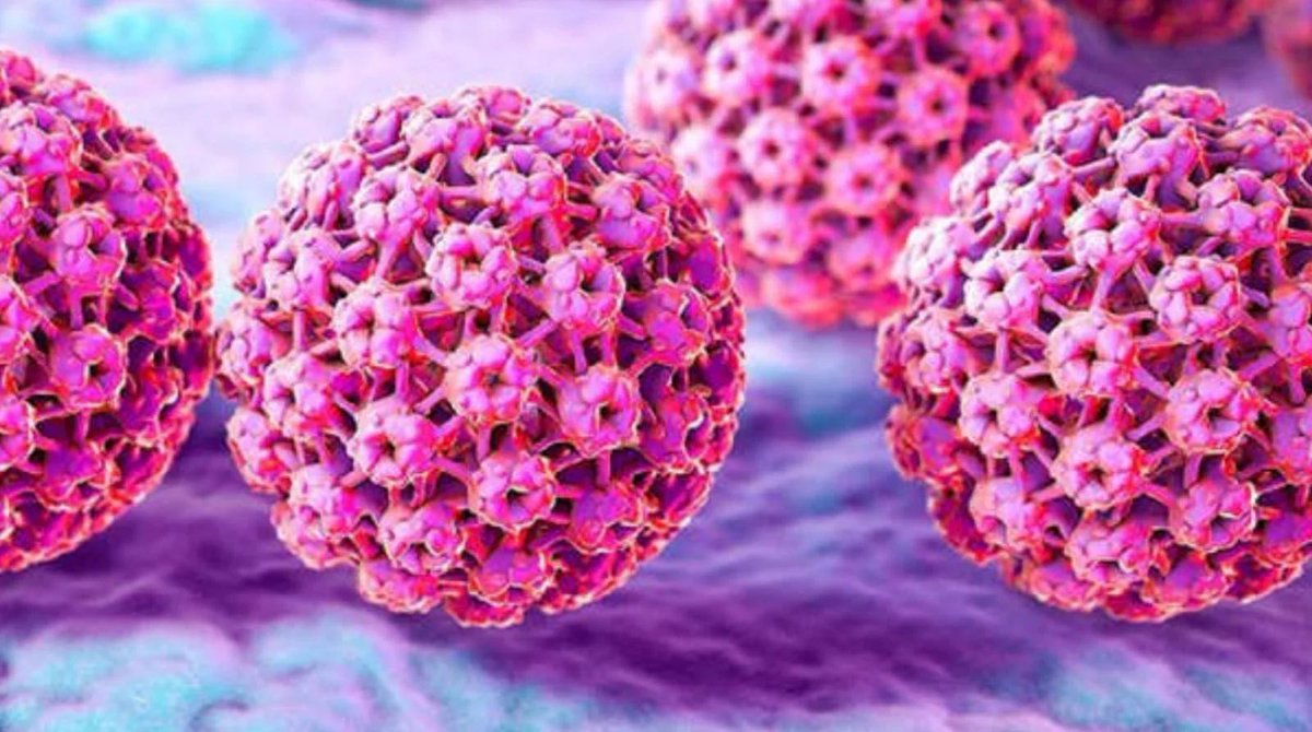 RealTimeRating's tweet photo. El virus del papiloma humano (VPH) ahora se puede eliminar por completo, gracias a investigadores mexicanos. https://t.co/js3JyYXfRA
