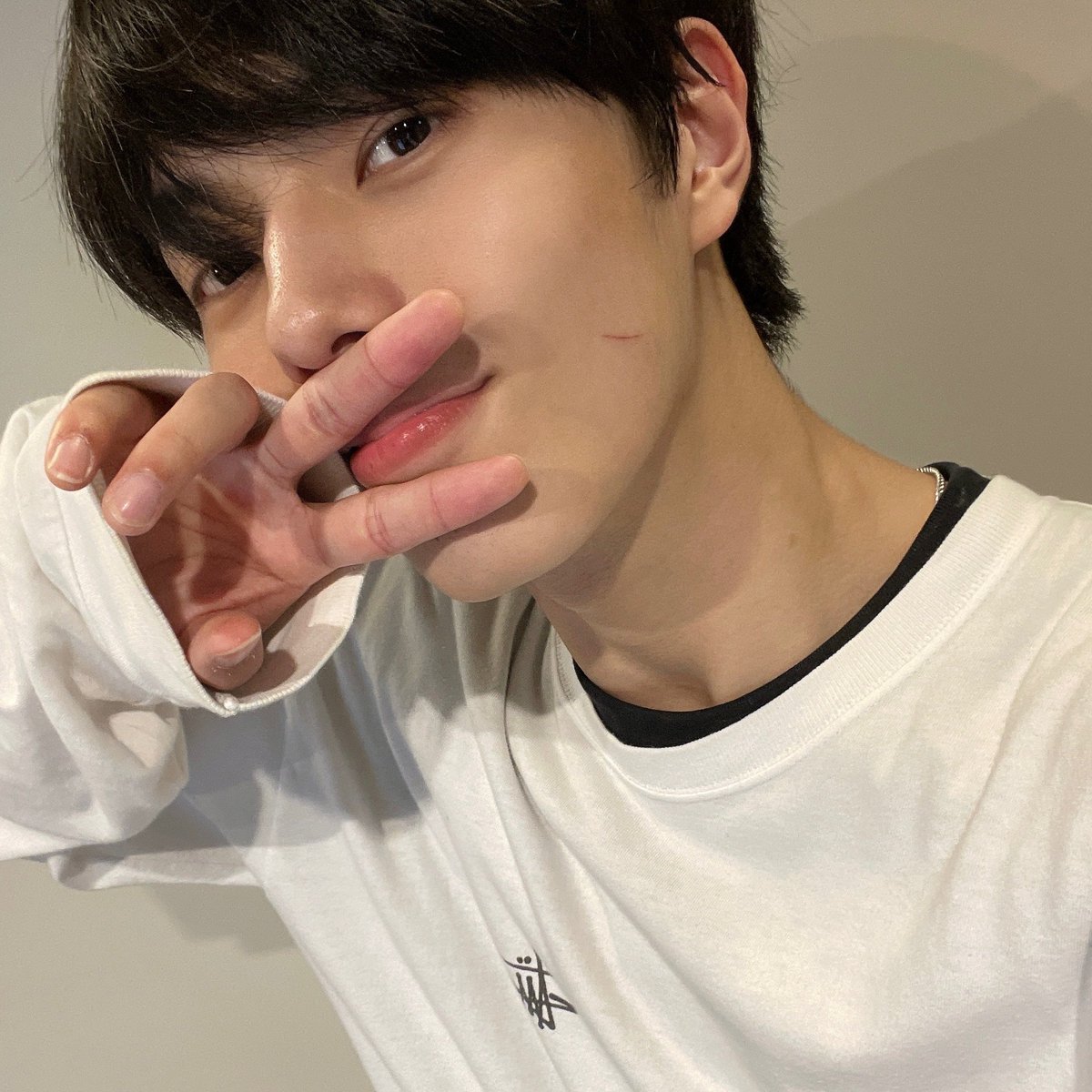 4__0dong's tweet photo. 면도 처음해봐서 볼에 상처 났대 미친 진짜진짜진짜 아간가봐 어떡해 https://t.co/DV4jnNcxK2