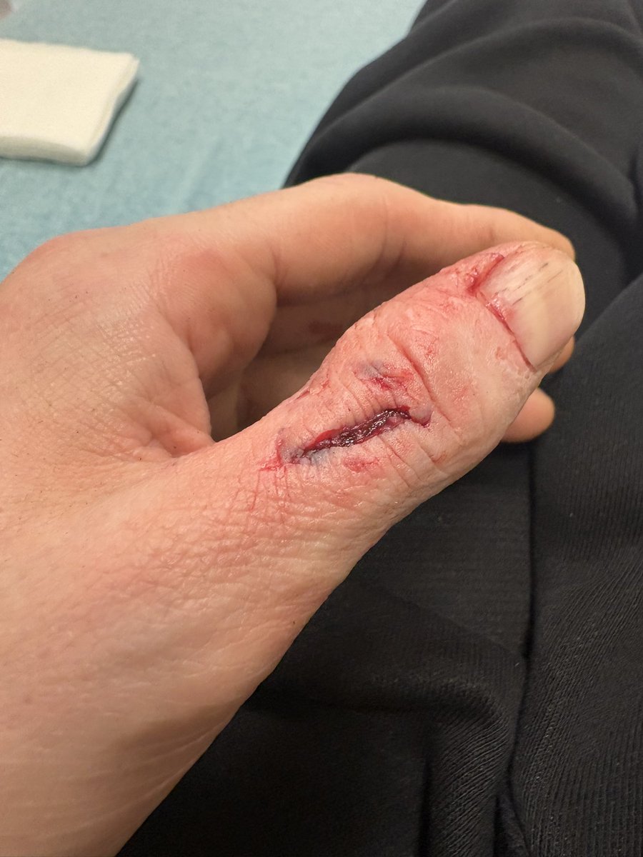 Chris Webby tweet media