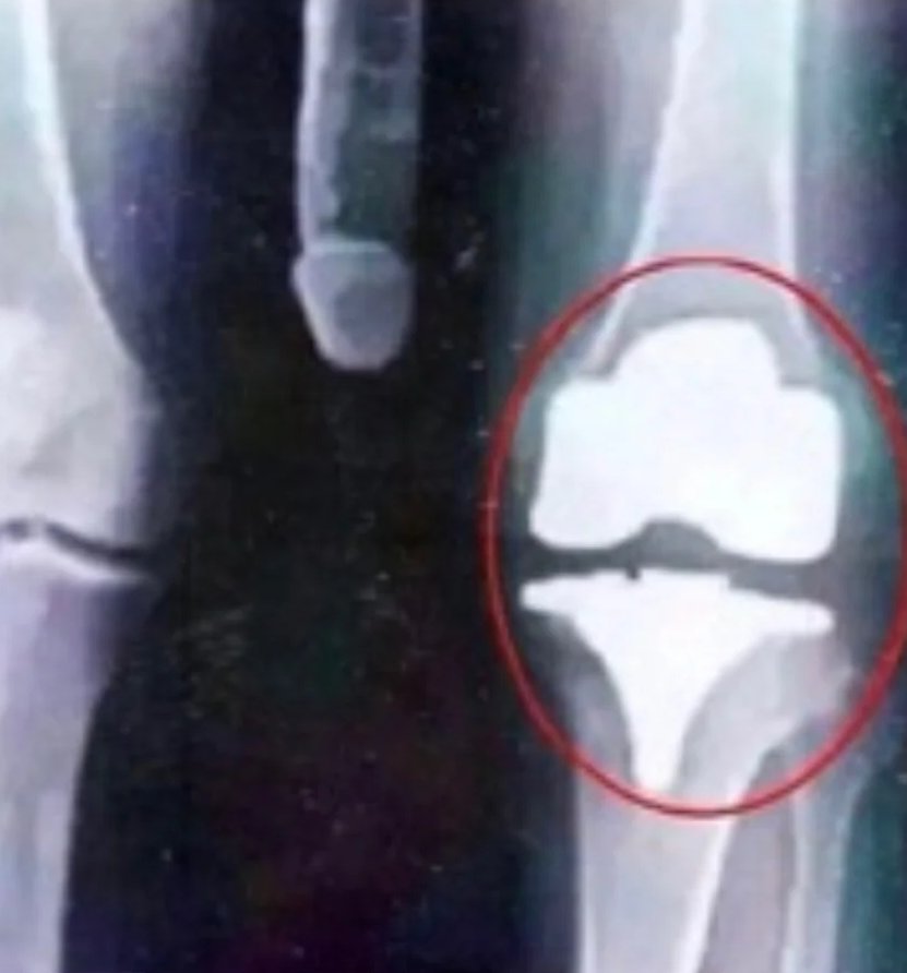 Maxx Crosby failed his physical with the Baltimore Ravens. This is insane.