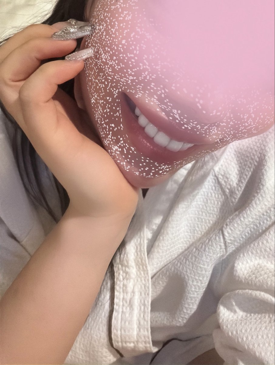 runa_3333_'s tweet photo. ミニッシュ歯科@minish_dental さんでお世話になってから3ヶ月🦷✨歯並びを気にするストレスが減って笑うことが楽しくなって自信がもてて周りからもすごく垢抜けたけど何が変わったんだろうって言ってもらえるくらい自然なのもすごく満足🥲🩷本当にやってよかったしもっとはやくすればよかった😭😭 https://t.co/7P76lzRUZN
