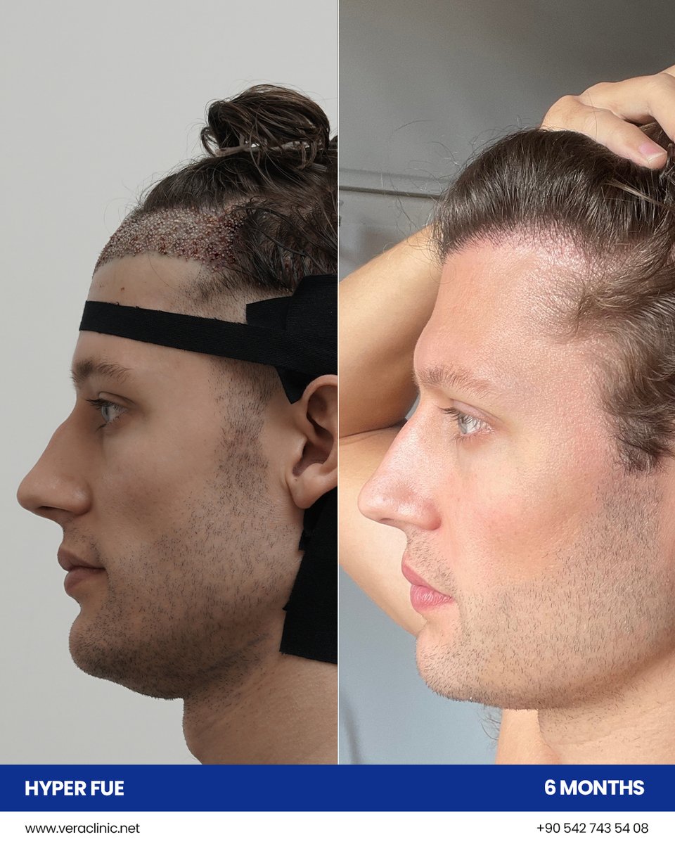 Vera Clinic tweet media