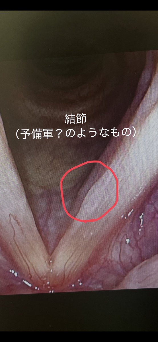 72m3arc888's tweet photo. 皆様にとって
『声』ってどんな存在ですか？

私のとって声は心臓と同じくらい
大事だと感じています。

それでも耳鼻科関係の疾患は、
就労不可というのが診断を出すことが難しいと知りました。

声を使う仕事だとしてもです。

働けるか働けないかは、
身体が動くか動かないかで判断する。 https://t.co/UigdSc6kpZ