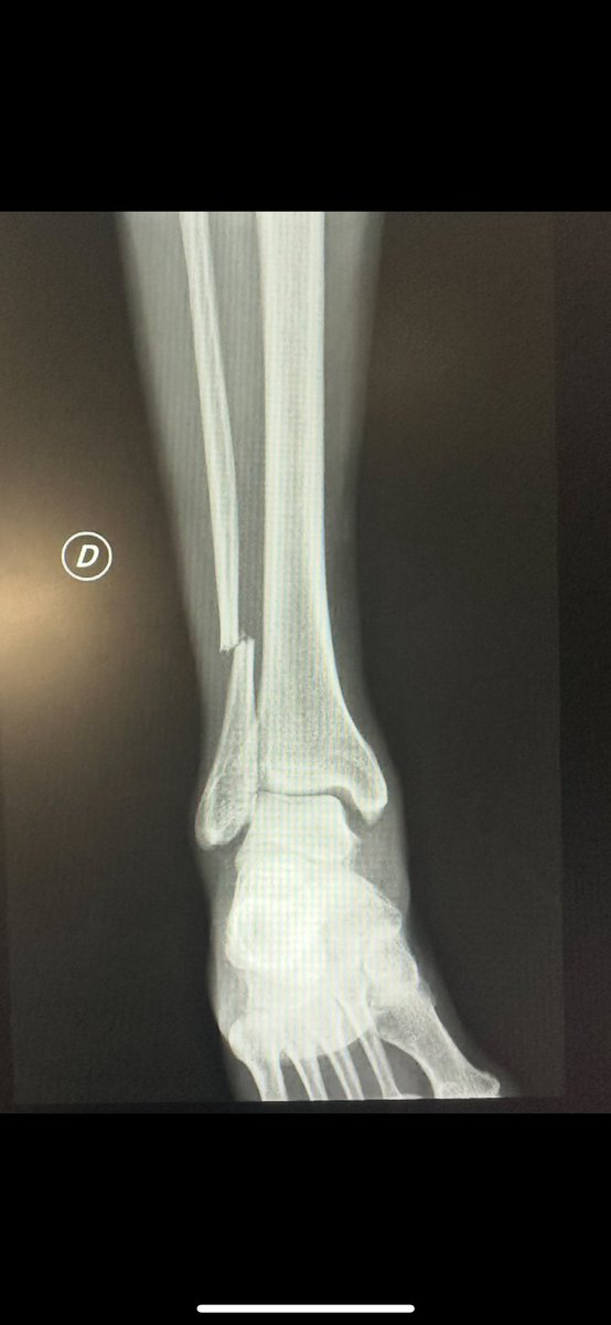 Chonchon 😾✌🏼 tweet media