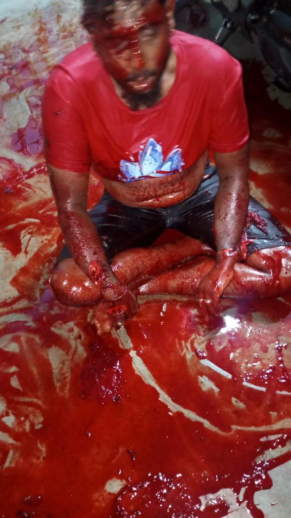 𝕏 ₮ⱤłǤǤ€® 🇲🇾 ₩∆Ɽ₦ł₦❾ tweet media