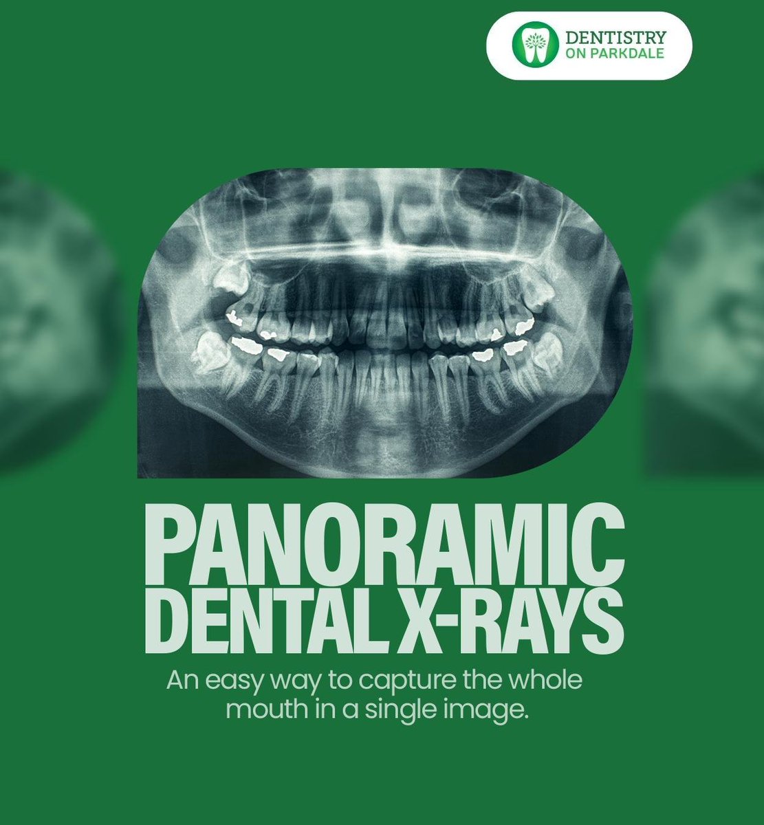 X-rays are a vital diagnostic tool that helps dentists identify dental problems and plan treatments for implants, extractions, and more. X-rays do not require any special preparation and are quick and painless.

dentistryonparkdale.com

#xrays #hamilton #ON #dentistryonparkdale