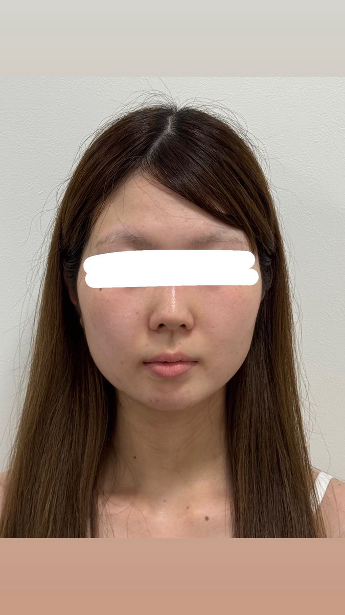 SEA CLINIC🌊小顔脂肪吸引ならシークリニック tweet media