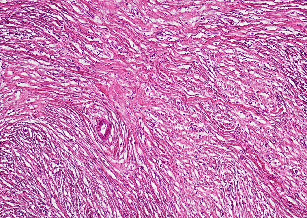 Guannan Zhang ,张冠楠,MD, PhD tweet media