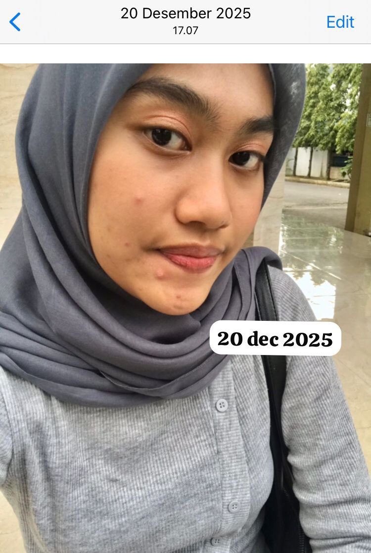 oraanih's tweet photo. Jerawatku dulu lumayan bikin insecure akhirnya nemu produk low budget yang😉 https://t.co/HXl5phEayS