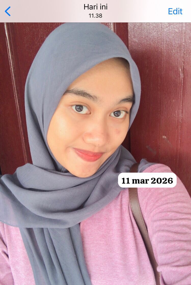 oraanih's tweet photo. Jerawatku dulu lumayan bikin insecure akhirnya nemu produk low budget yang😉 https://t.co/HXl5phEayS