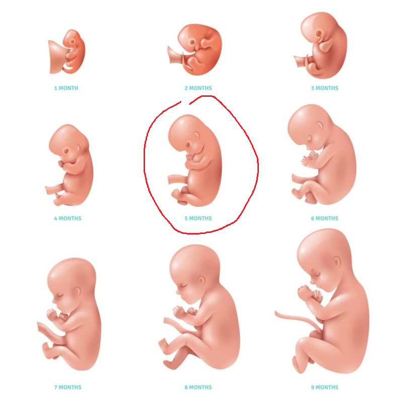 태어나고 21주만에 숨진거면 모를까 21주 만에 태어난거면 5개월차 태아야... 인큐베이터 들어가도 살릴 수 있겠냐고...