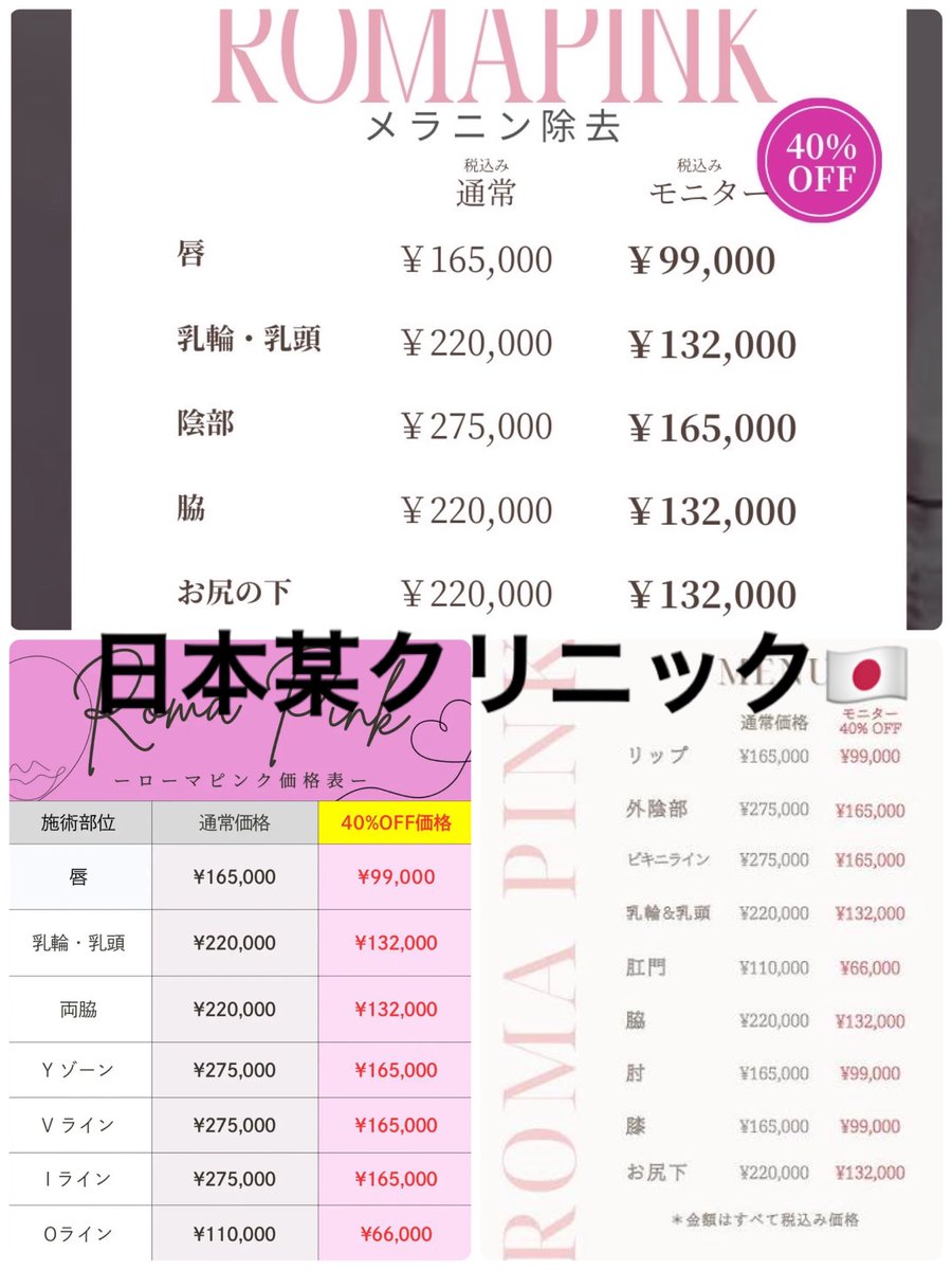 ARICHAAAAAAMU's tweet photo. ねぇ日本のメラピンク1回で乳首だけで40%オフで１３万とかやばくなぃ⁉️定価２２万で驚いたんだが。私の行ってる韓国の店は乳首2回で６万だよ。1回約３万。VIO🇯🇵定価100万🤣韓国9万なのに?なんで日本こんな高いの? 教えてほしい。しかも私の紹介でクリームまでつけてくれるのに。予約したい人だけDMして https://t.co/f16GLHbjth
