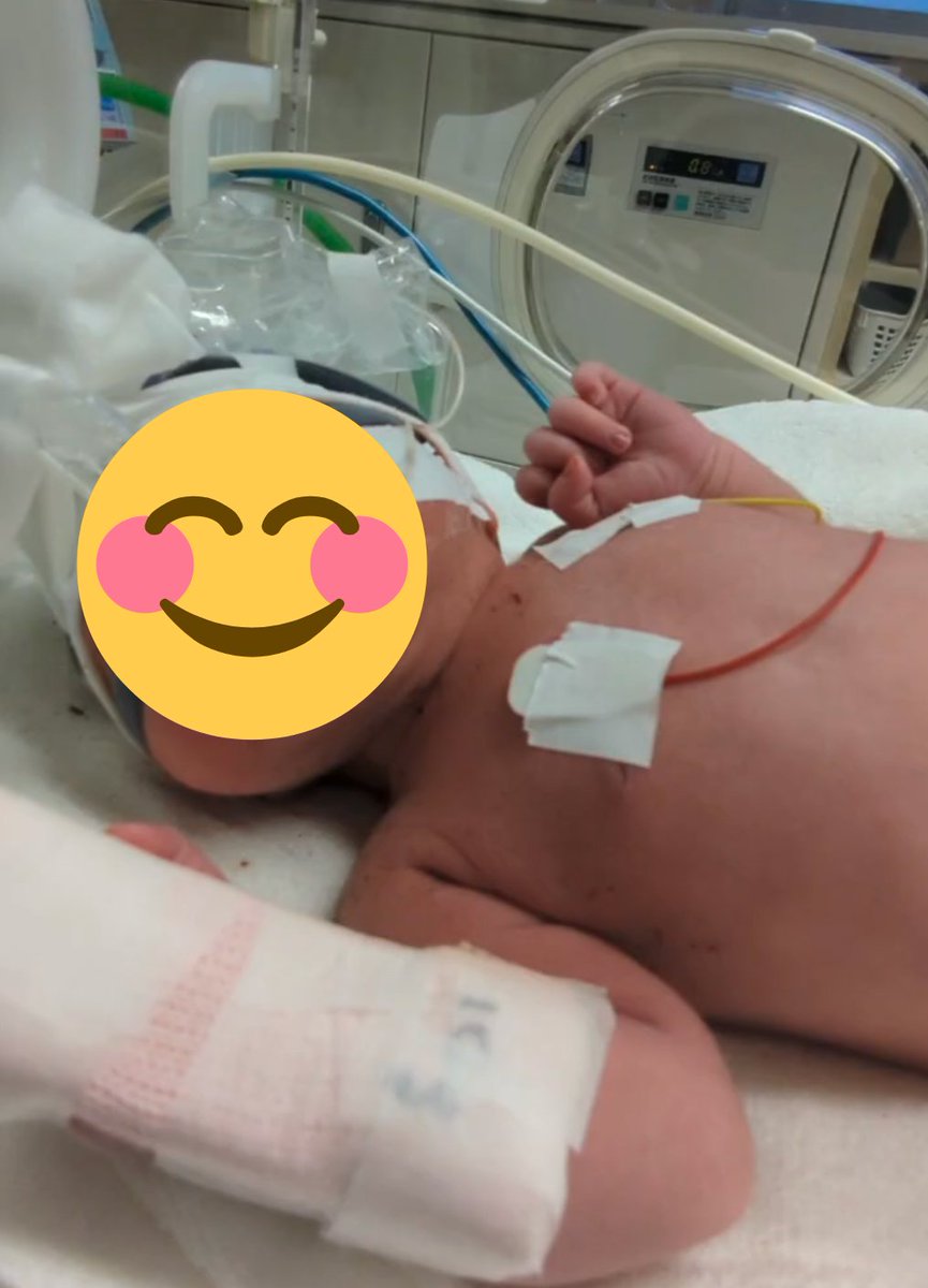 先日、無事に第一子となる女の子を出産いたしました👶

お産直後は、👶の肺の関係でNICUに入ったり、嫁の手術が重なったりと想像を絶する大変さでしたが、現在は母子ともに順調に回復しています
「生きてるだけで丸儲け」を身にしみて感じました。

今後とも変わらぬお付き合い、よろしくお願いします!