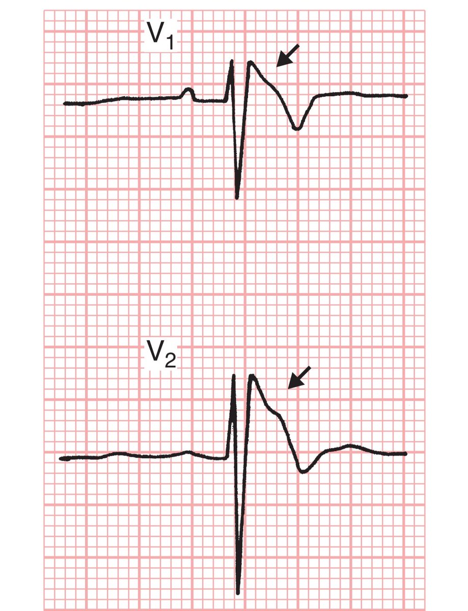CardiovascularCorner tweet media
