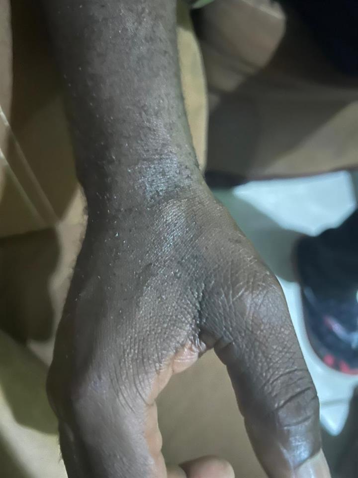 dailysunsa's tweet image. Eina! Madala 'chomps' on cop’s thumb!
All the drama took place in Hammankraal.
snl24.com/dailysun/news/…
#Cop #Assault