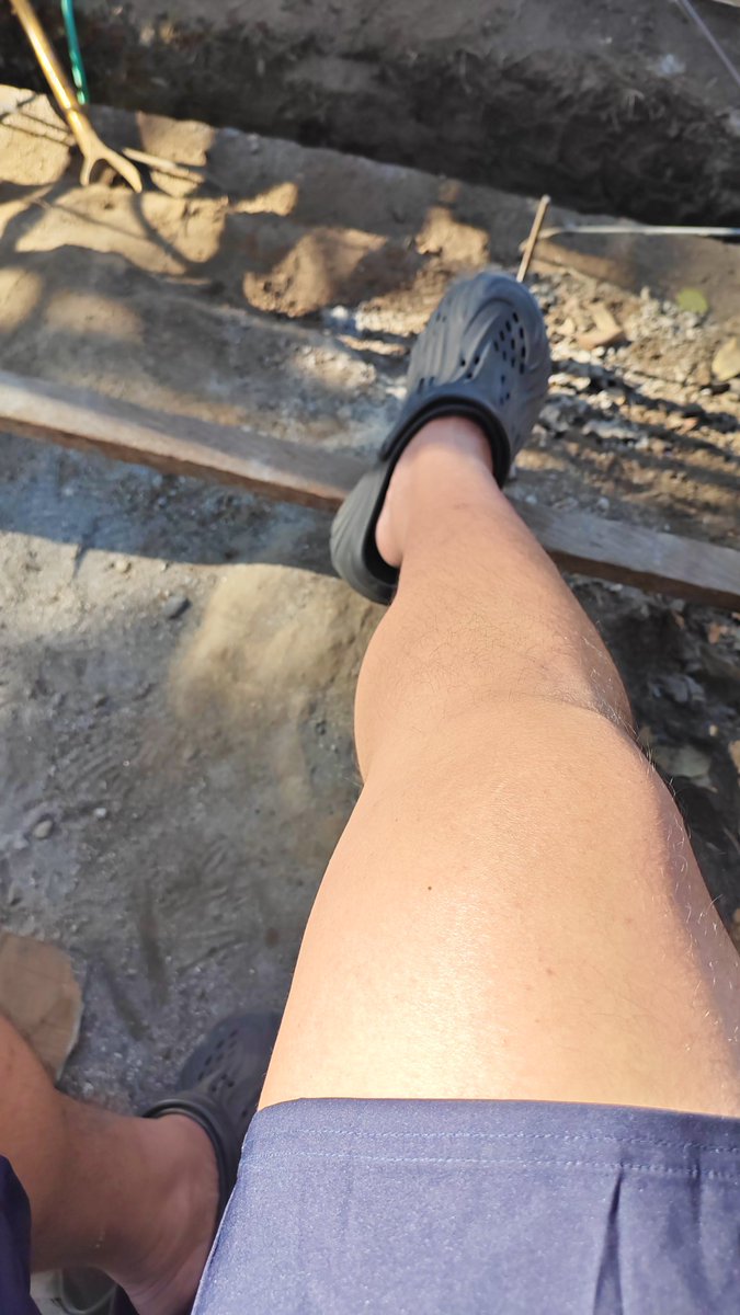 CJgramar's tweet photo. Gunna Sunbathe Them legs!! Literally have the same color pattern of a panda!!! 😆😆😆🐼 https://t.co/0JbbsJms3f