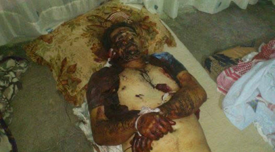 AramKurd01's tweet photo. #showreşa_rojava
#JusticeforAlaa
مجزرة كوباني 23/6/2013
على يد مسلحيPYDوPKKفي قرية تل غزال بحق الشعب الكوردي
 الشهداء:محمود ابراهيم عمي
محمد حمو عبدو وابنه مصطفى حمو عبدو وجرح ثلاثة آخرين وهم: مصطفى كنو محمد ومحمد أمين عزيز شاهين وأفيندار عطي مصطفى وإعتقال آخرين.... https://t.co/VV1RjYL7pM