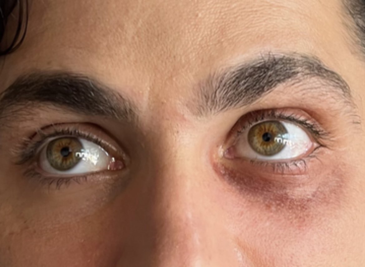 😍😍😍😍😍😍😍😍😍😍😍😍😍