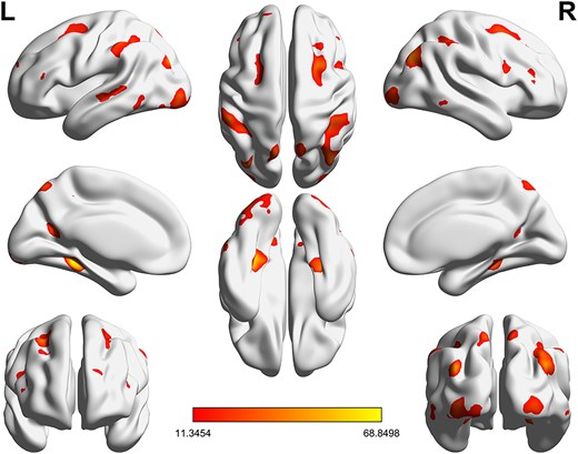 Psychoradiology tweet media