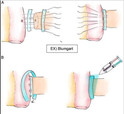 Annals of Surgery tweet media