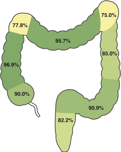 EndoCollab™ | GI Endoscopy Community tweet media