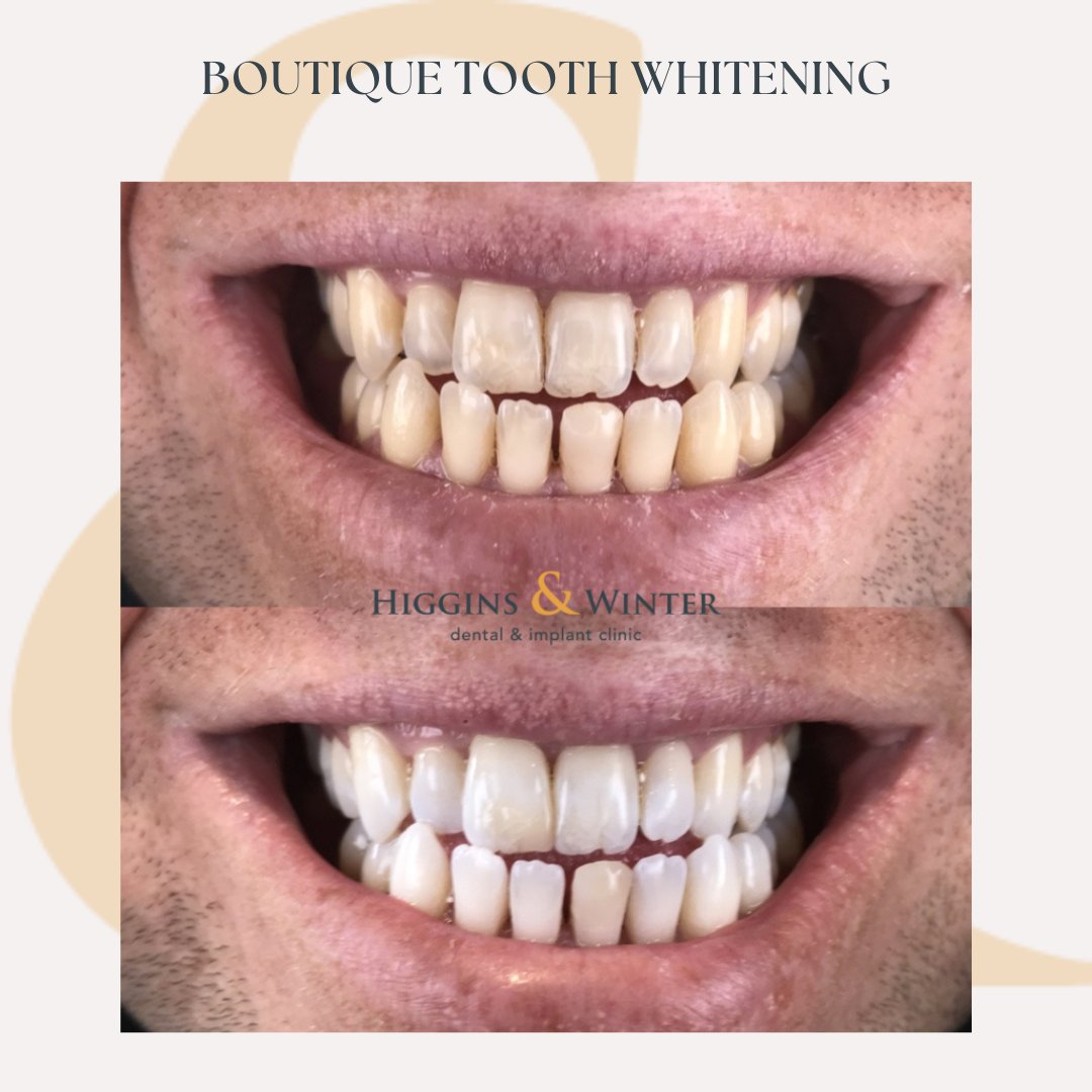 Higgins & Winter Dental & Implant Clinic tweet media