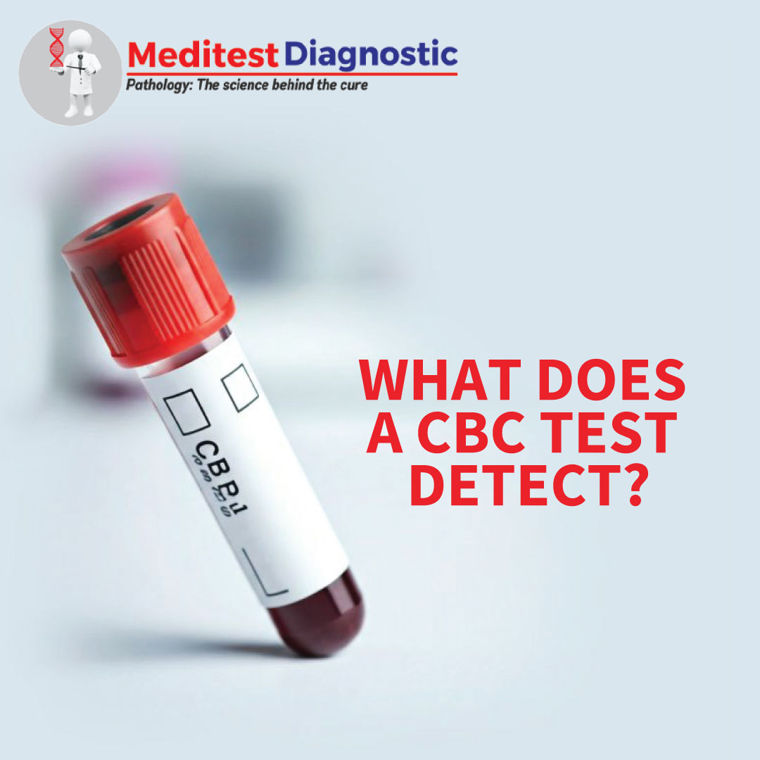 MeditestGroup's tweet image. Your blood carries powerful clues about what’s happening inside your body. 
Take a proactive step toward your health today.

#MeditestDiagnostic #CBCTest #BloodTest #HealthCheckup #PreventiveHealth #EarlyDiagnosis #modiji #indianstartup #raghav #kerara #aap