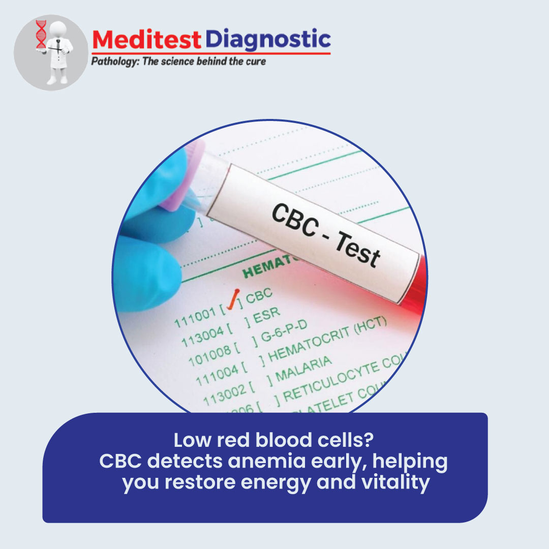 MeditestGroup's tweet image. Your blood carries powerful clues about what’s happening inside your body. 
Take a proactive step toward your health today.

#MeditestDiagnostic #CBCTest #BloodTest #HealthCheckup #PreventiveHealth #EarlyDiagnosis #modiji #indianstartup #raghav #kerara #aap
