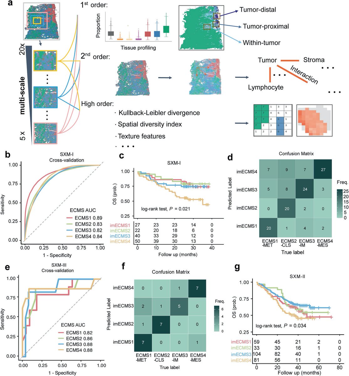 Oncologynewspro's tweet image. @STTTJournal: an AI classifier using routine H&amp;amp;E pathology slides—no expensive sequencing needed. 
This enables precision subtyping &amp;amp; personalized treatment at lower cost, bringing real clinical utility to ESCC care.Primary: 
#ESCC #PrecisionMedicine #AI #Pathology