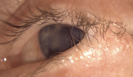 OptometricManagement tweet media