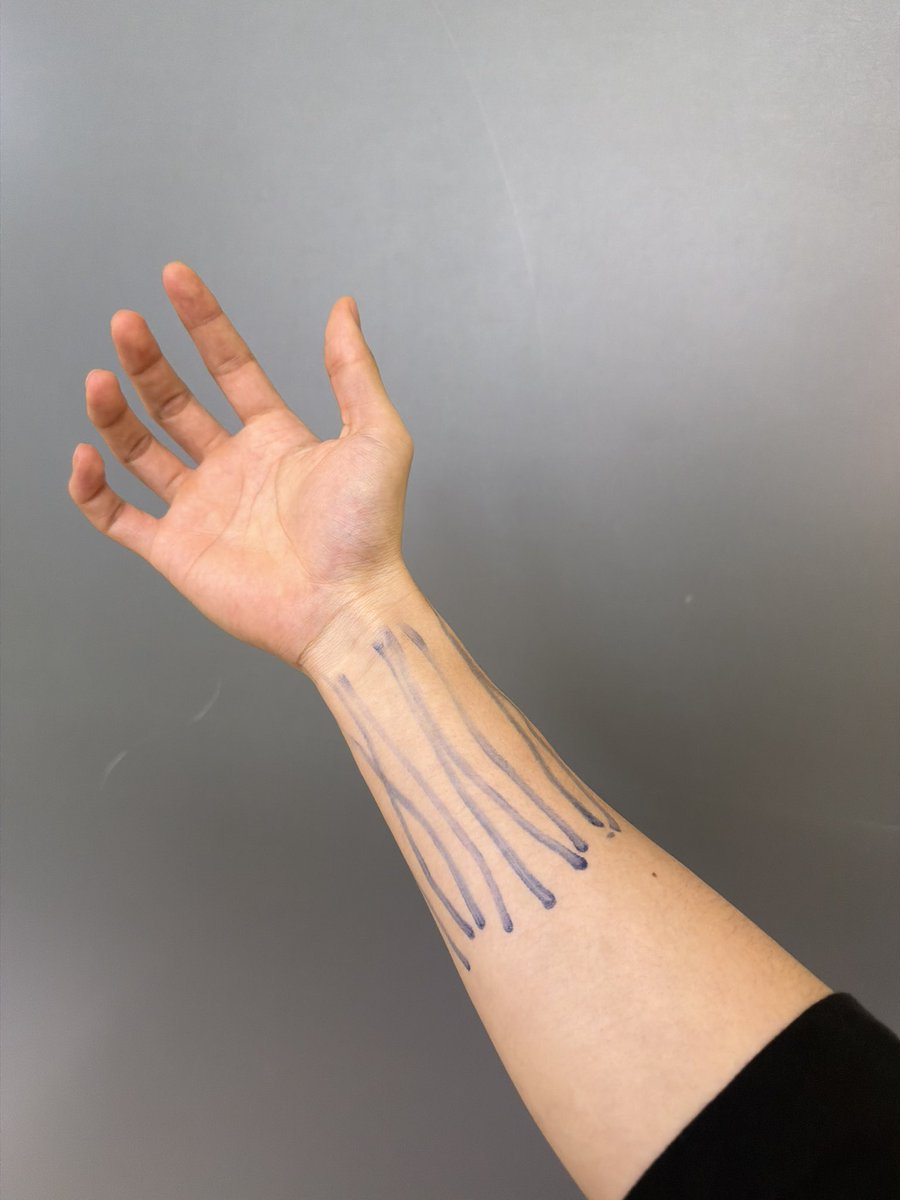 ข้อคิดวันนี้  :  ไม่มีใครขีดเส้นให้เราหรอก มีแต่เรานี่แหละที่ขีดเส้นให้ตัวเอง