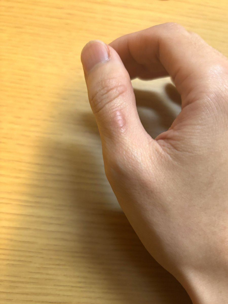 apteryxnil's tweet photo. 俺のサックスダコ見て https://t.co/IRJixAaucC