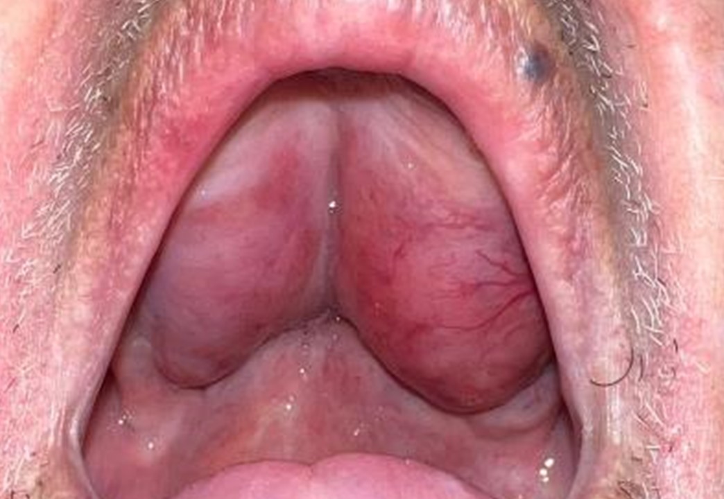 Felipe Fonseca, DDS tweet media