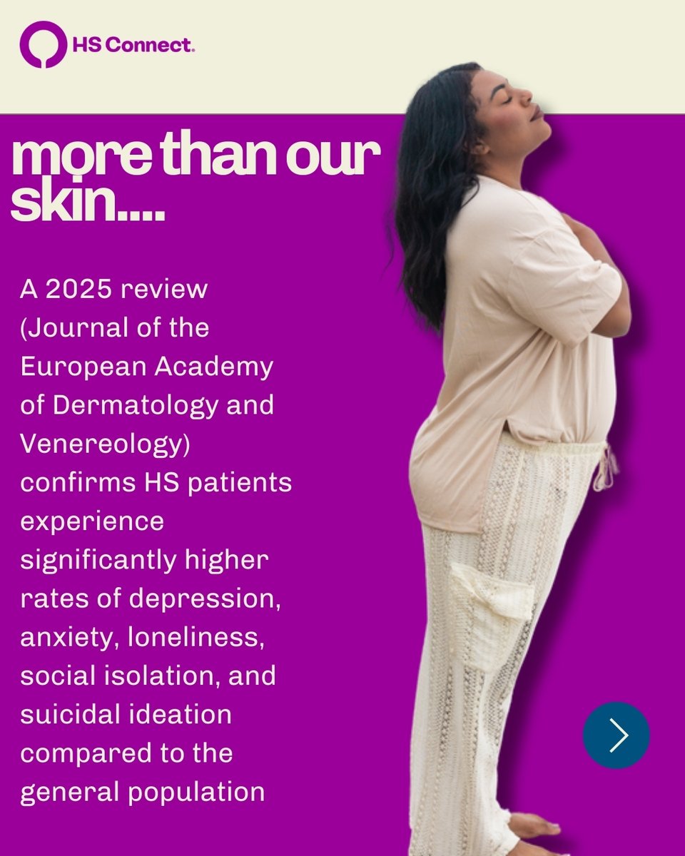 HSConnectOrg's tweet image. HS affects more than just the skin. Your mental health matters, too. 🤍 You deserve support, understanding, and space to heal.

#HSConnect #HidradenitisSuppurativa #HSCommunity #LivingWithHS #MentalHealth