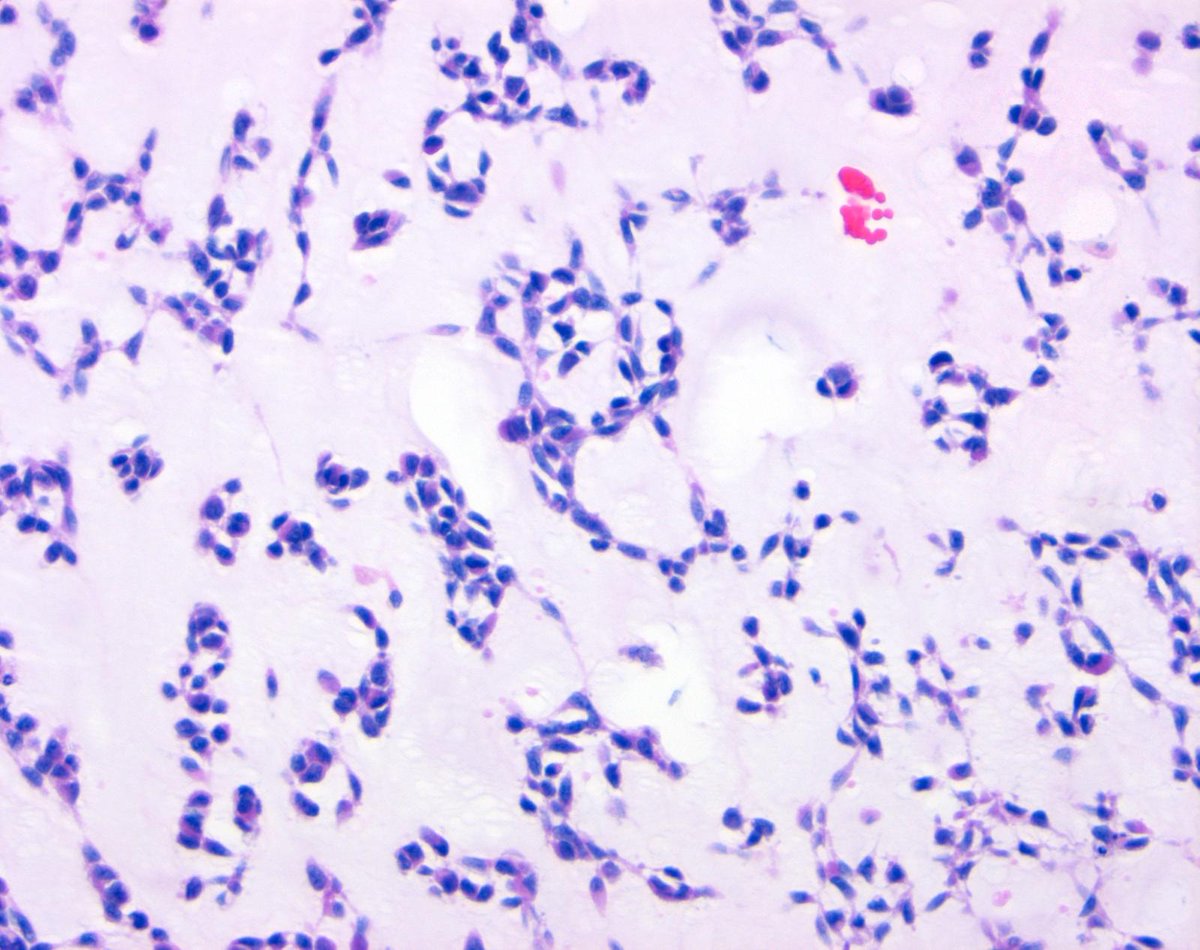 Charlie Herndon tweet media