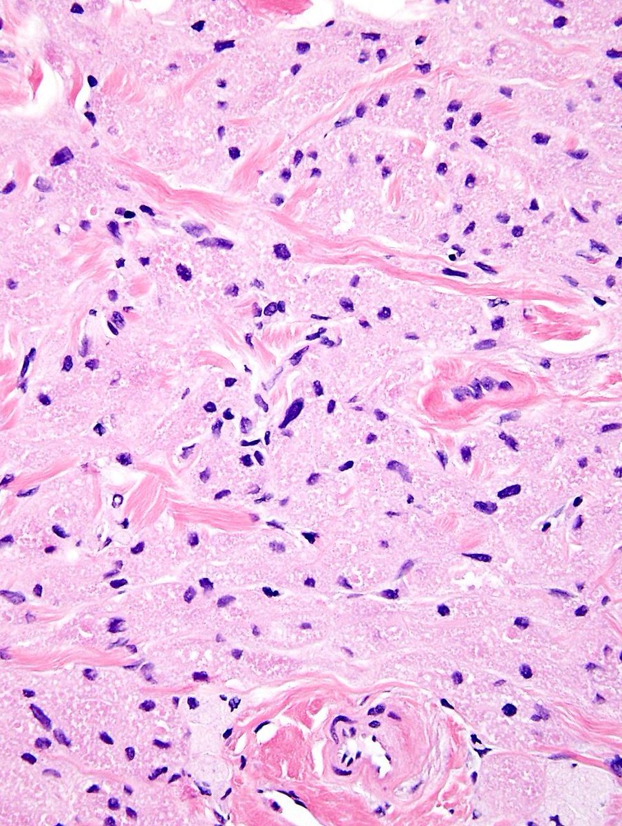 Charlie Herndon tweet media