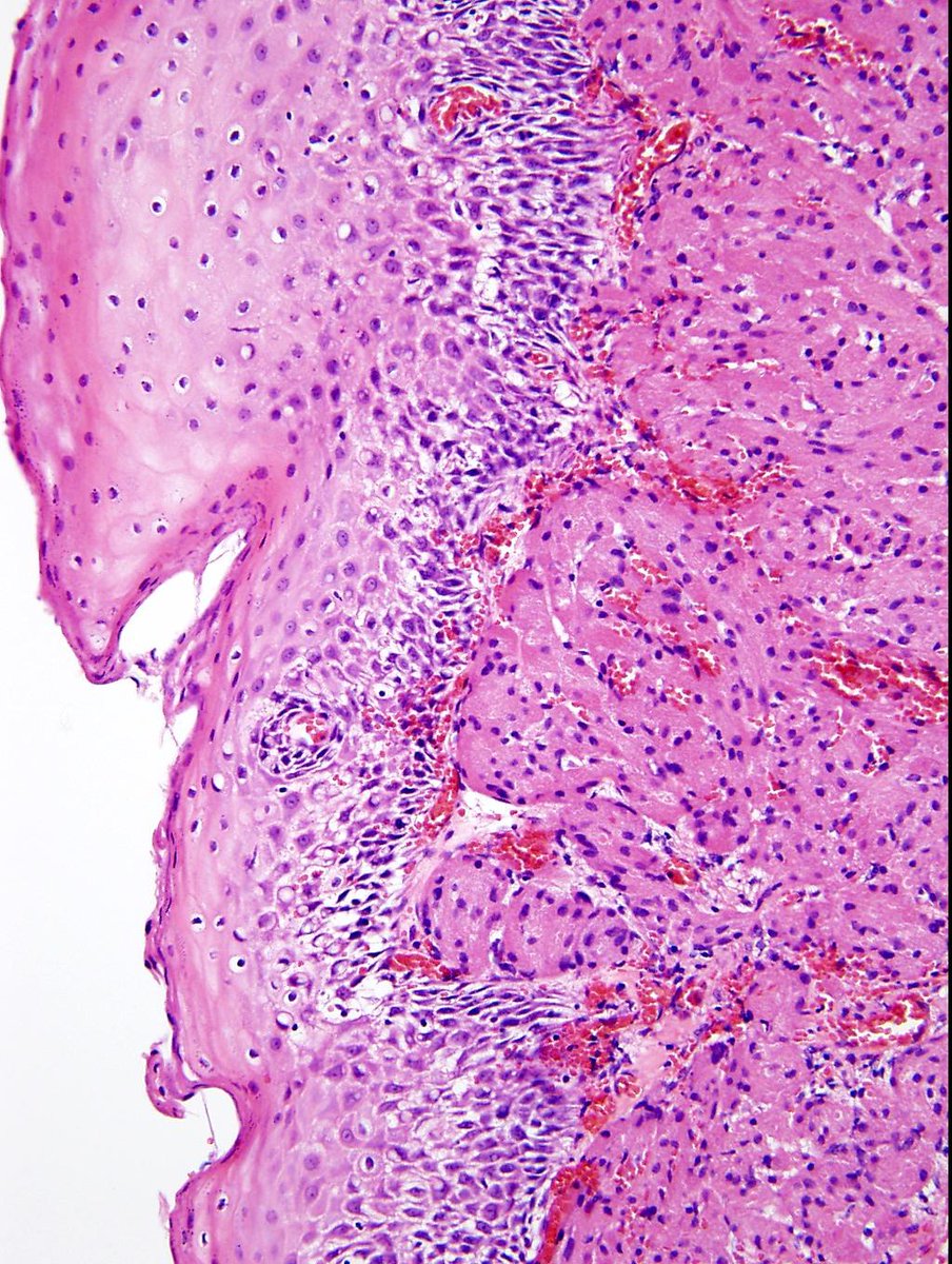 Charlie Herndon tweet media