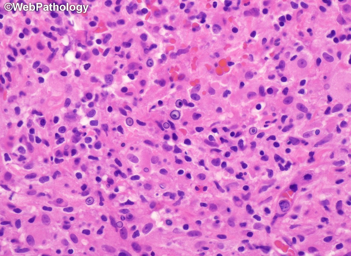 WebPathology tweet media