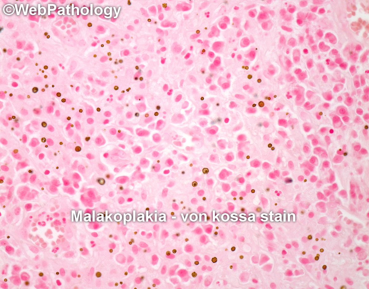 WebPathology tweet media