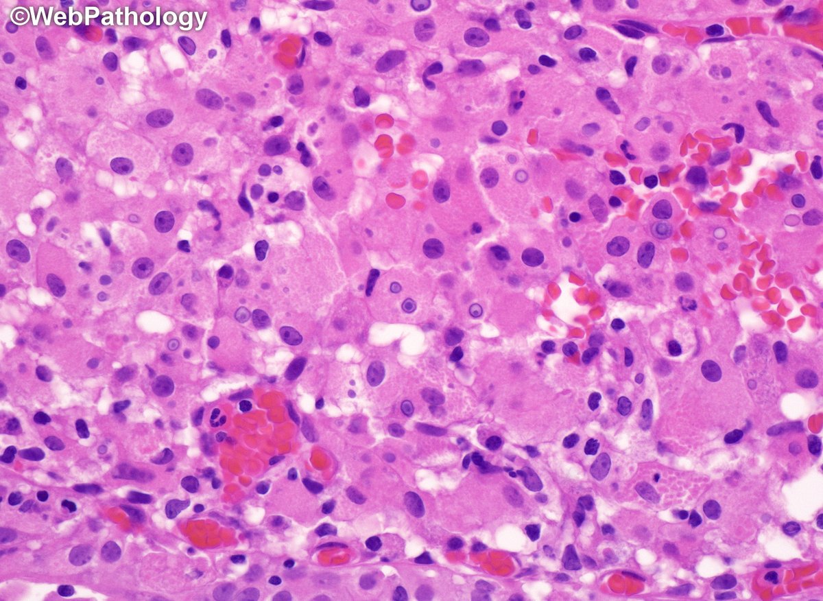 WebPathology tweet media