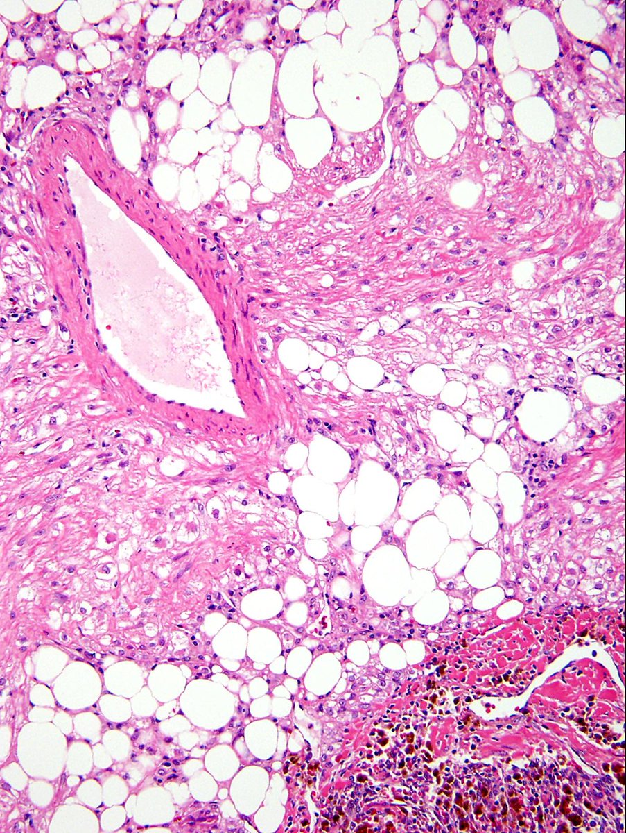 Charlie Herndon tweet media