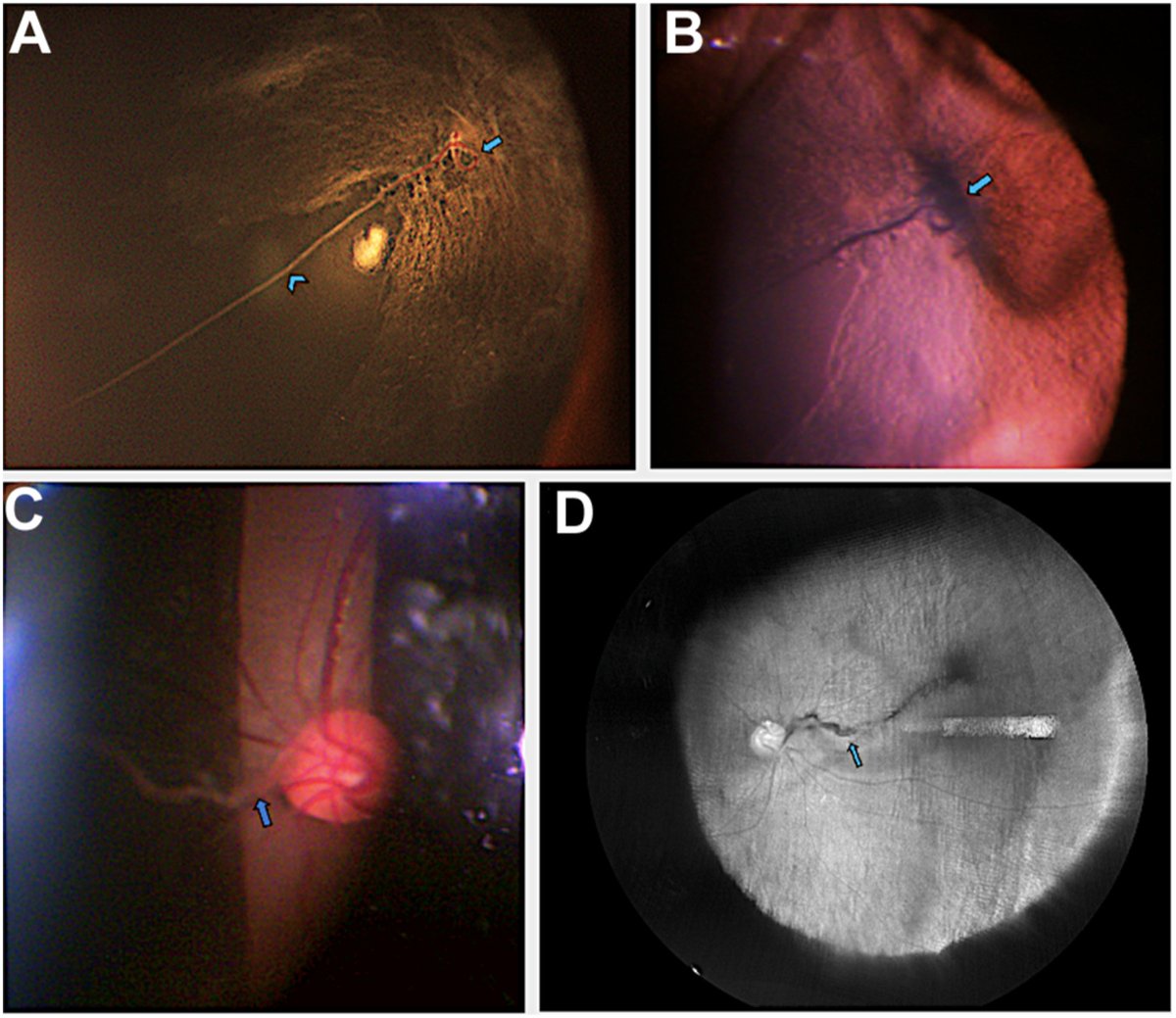 Ophthalmology tweet media