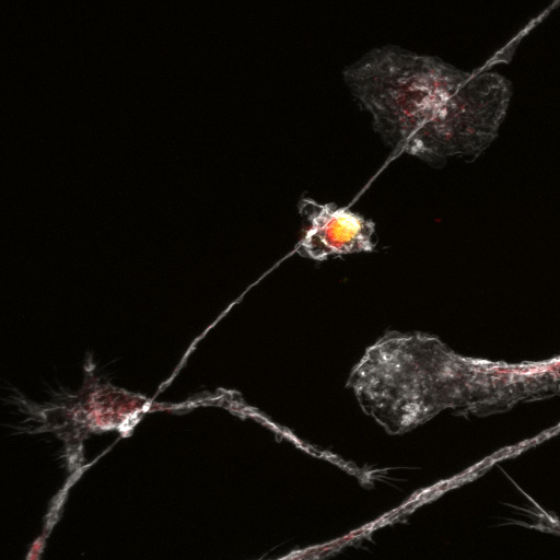 Tammy Kielian tweet media