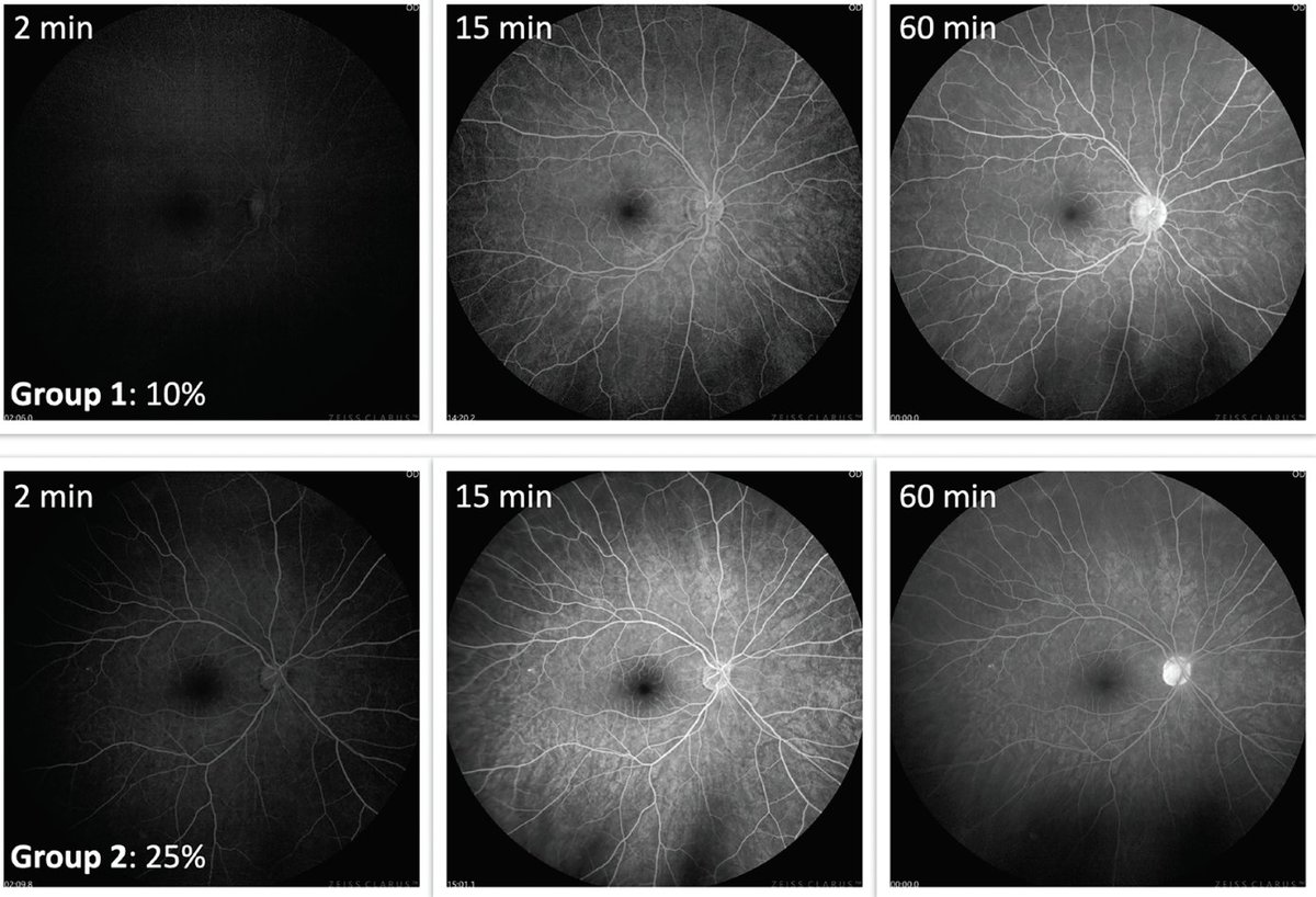 Retina Specialist tweet media