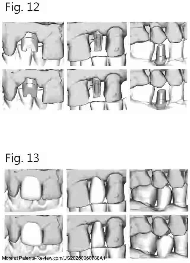 PatentPulse's tweet image. Discover the future of #DentalTech with patent application #US20260060788A1 by #DentsplySirona. This innovation uses #MachineLearning for real-time, customized dental designs, including crowns &amp;amp; abutments. It ensures immediate validation of patient-specific treatment plans.
